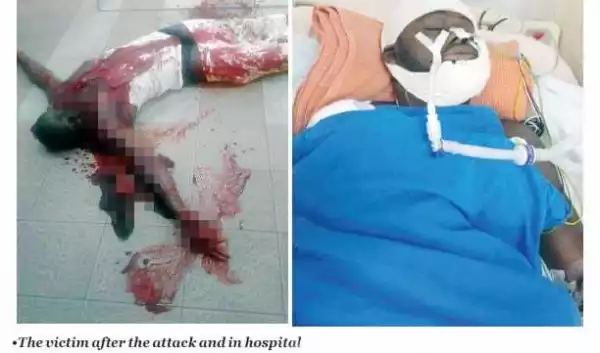 Photos + Video : Update on Nigerian hacked with sword, machete by cultists in Malaysia